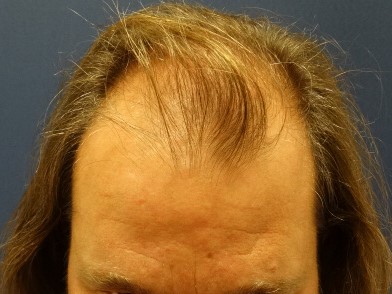 index.php/fa/34627/0/