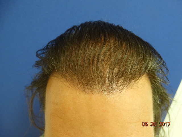 index.php/fa/34628/0/