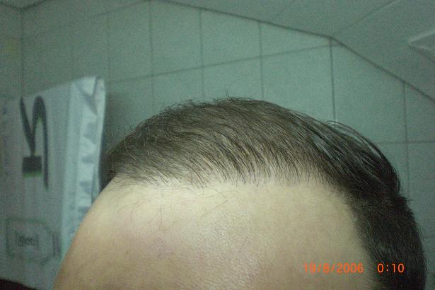 index.php/fa/3464/0/