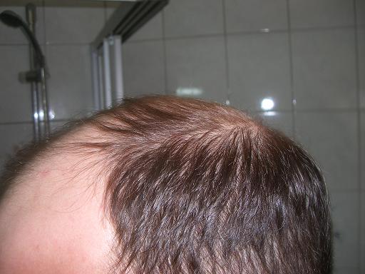 index.php/fa/3465/0/