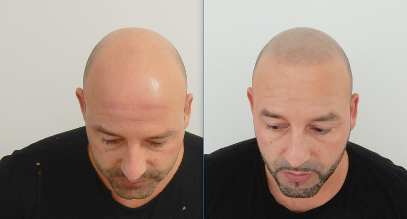 index.php/fa/34775/0/