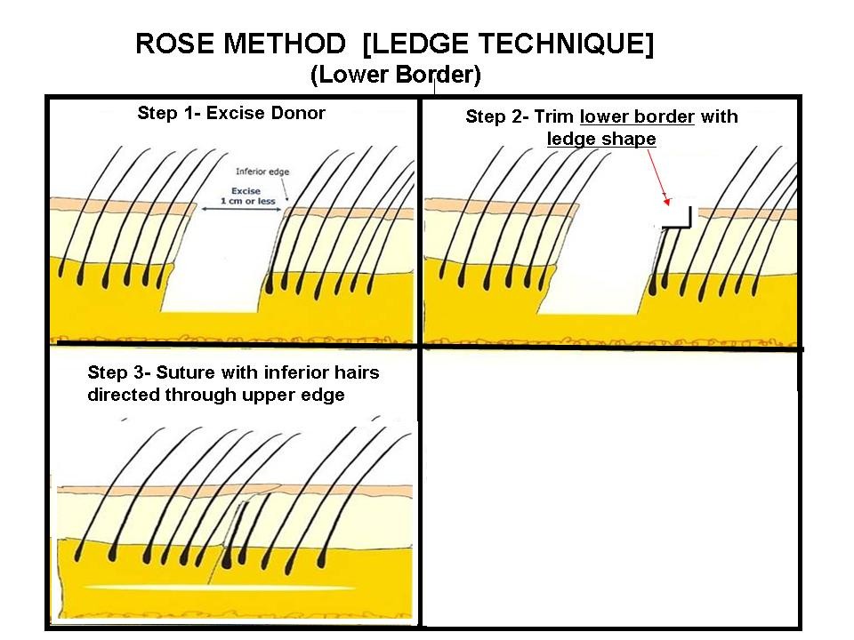 index.php/fa/3488/0/