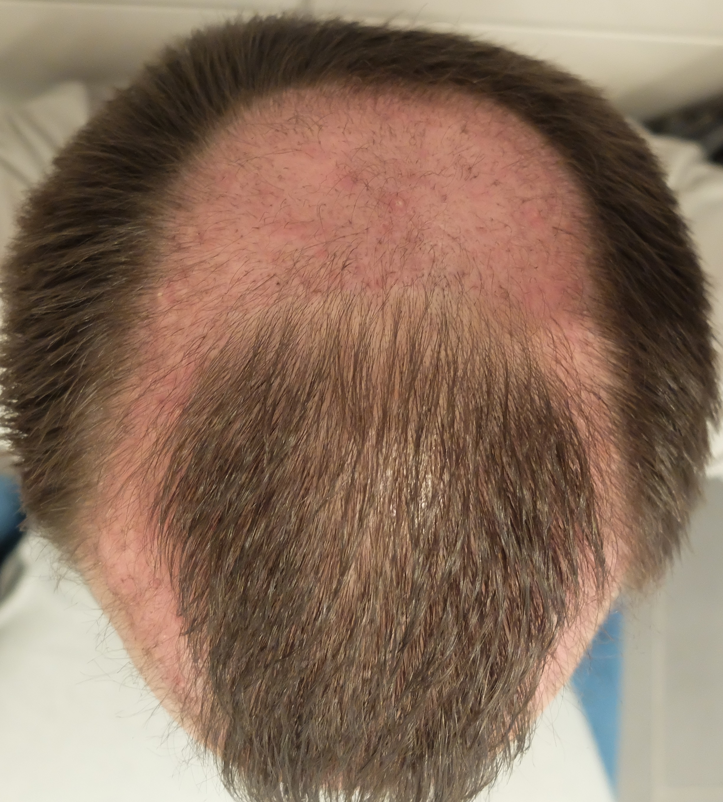 index.php/fa/34907/0/