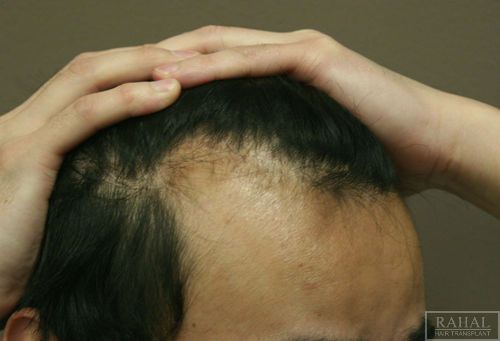 index.php/fa/3493/0/