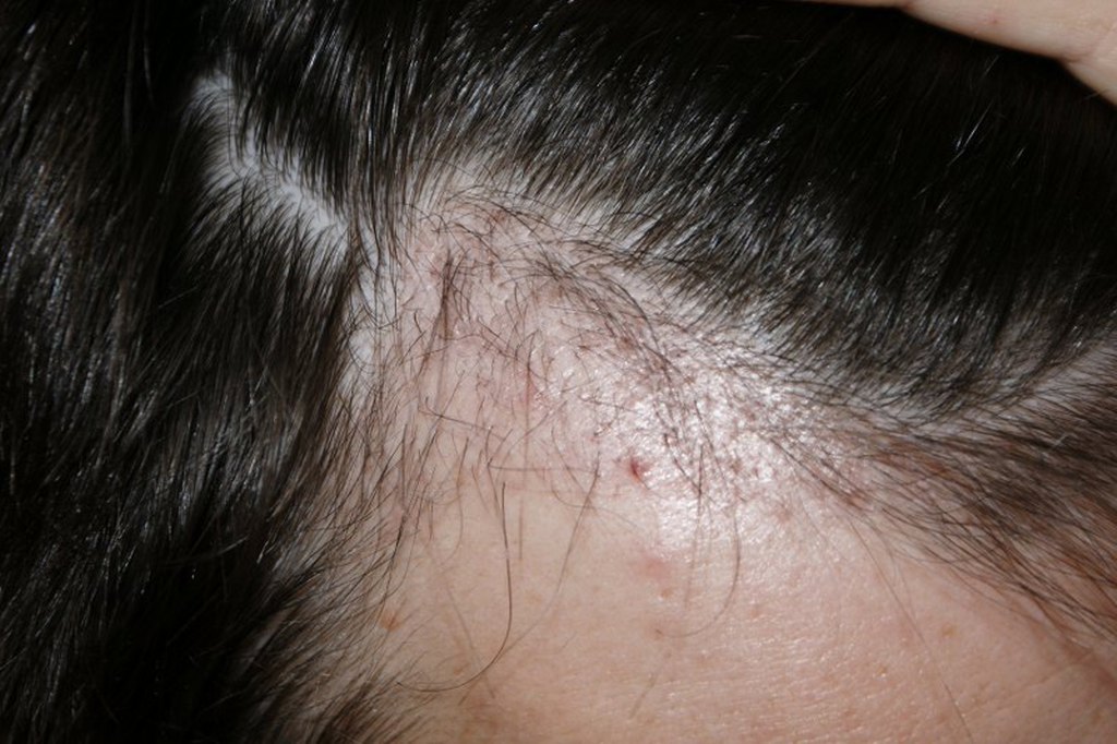 index.php/fa/3495/0/