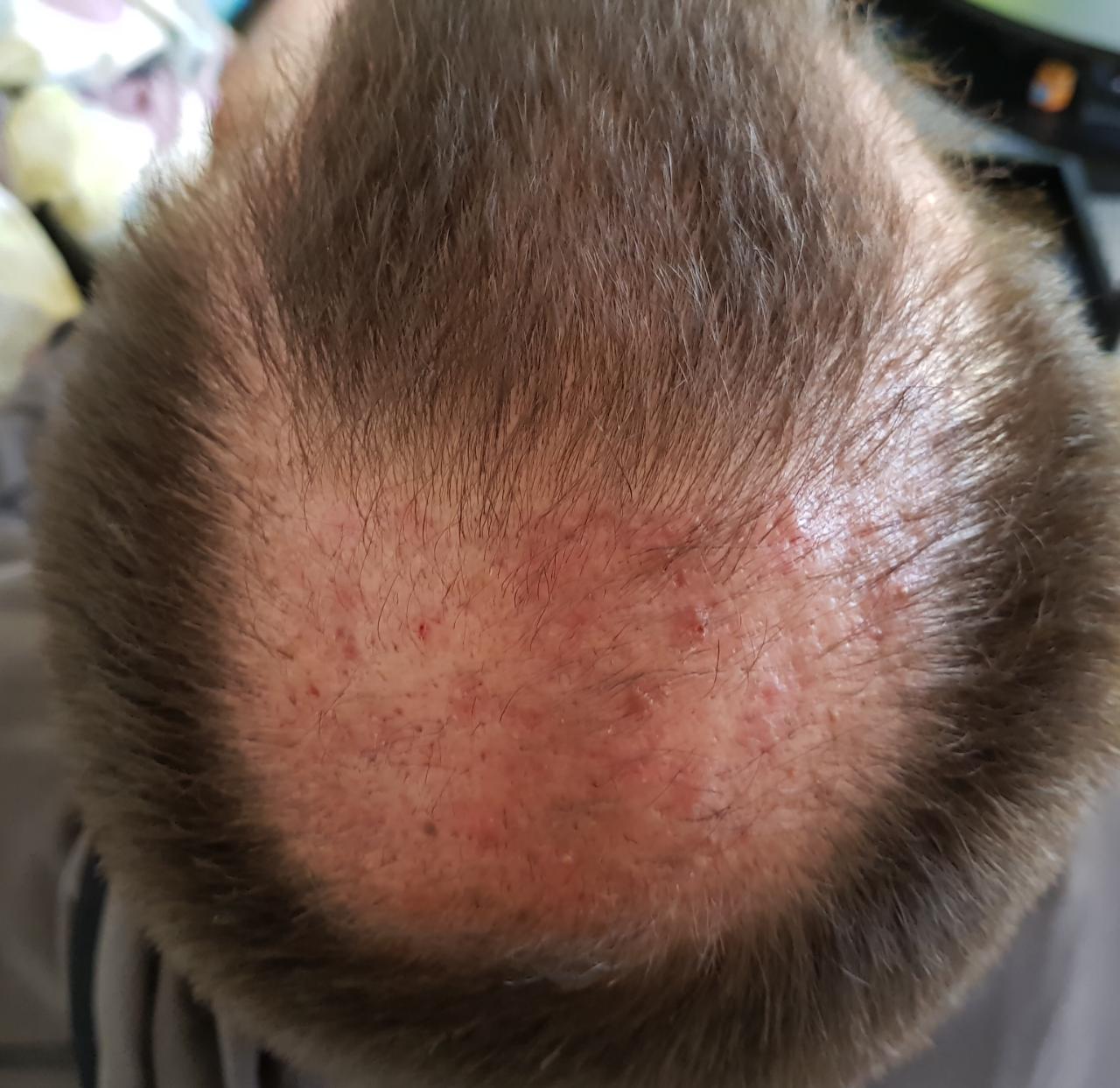 index.php/fa/35069/0/