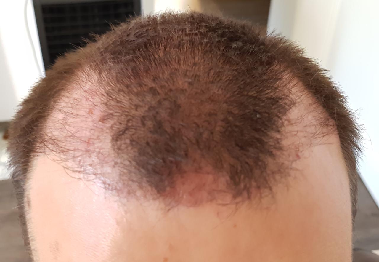 index.php/fa/35070/0/