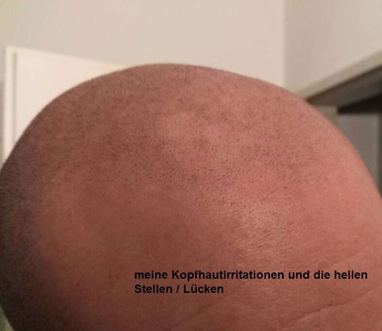 index.php/fa/35118/0/