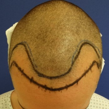 index.php/fa/35176/0/