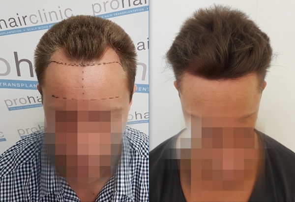 index.php/fa/35217/0/