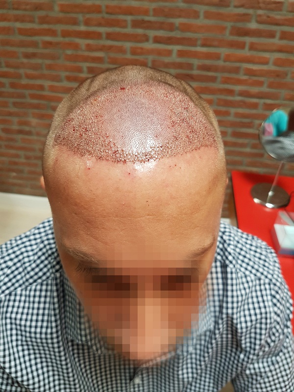 index.php/fa/35219/0/