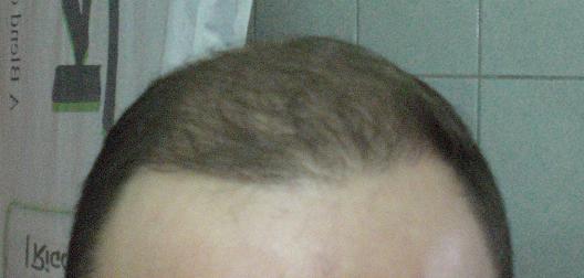 index.php/fa/3522/0/