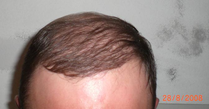 index.php/fa/3523/0/