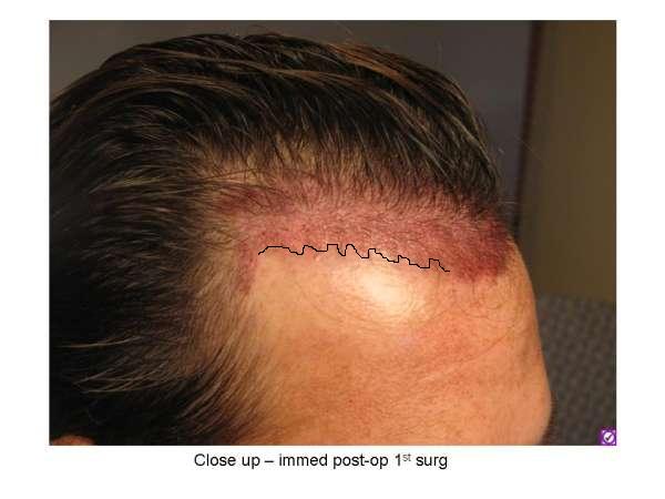 index.php/fa/3531/0/