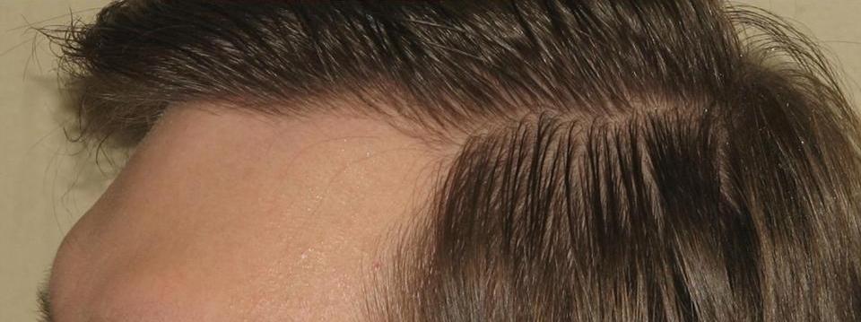 index.php/fa/3532/0/