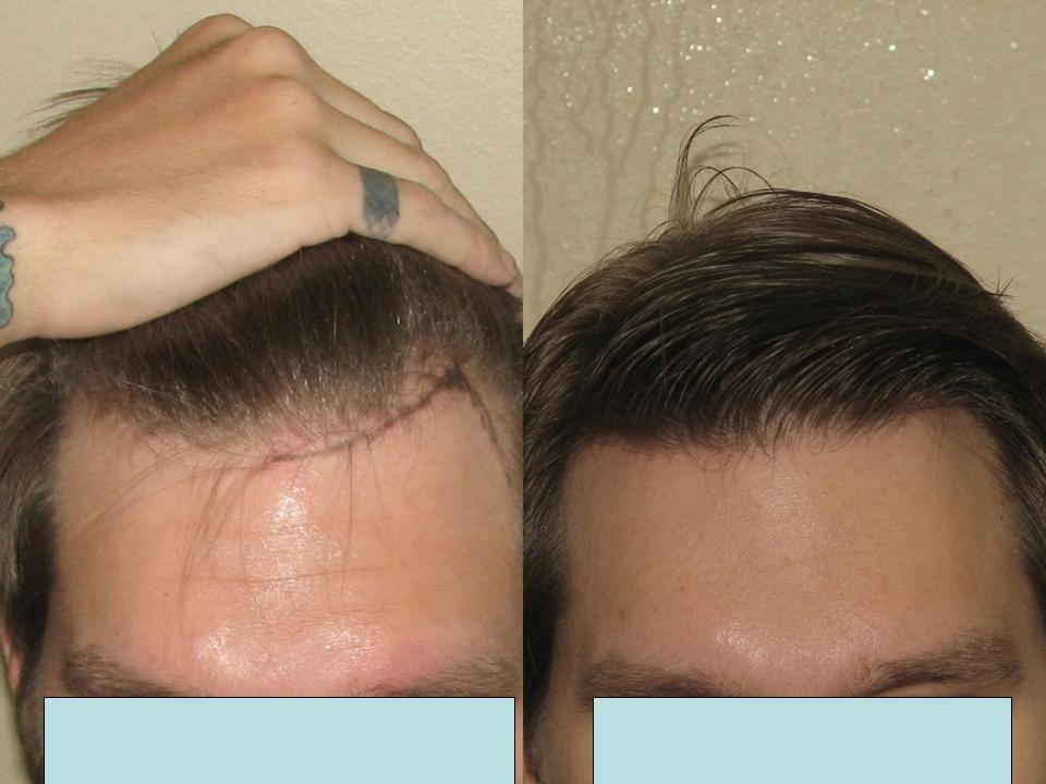 index.php/fa/3533/0/