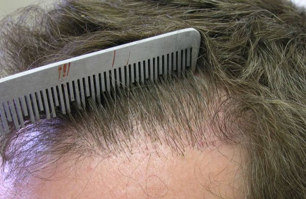 index.php/fa/3534/0/