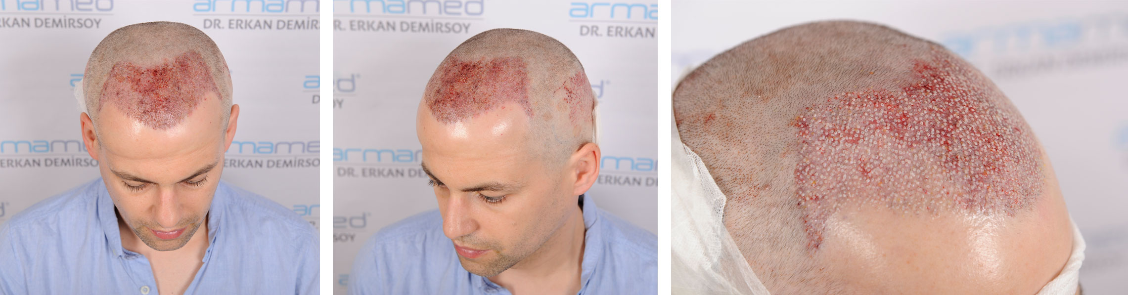 index.php/fa/35701/0/