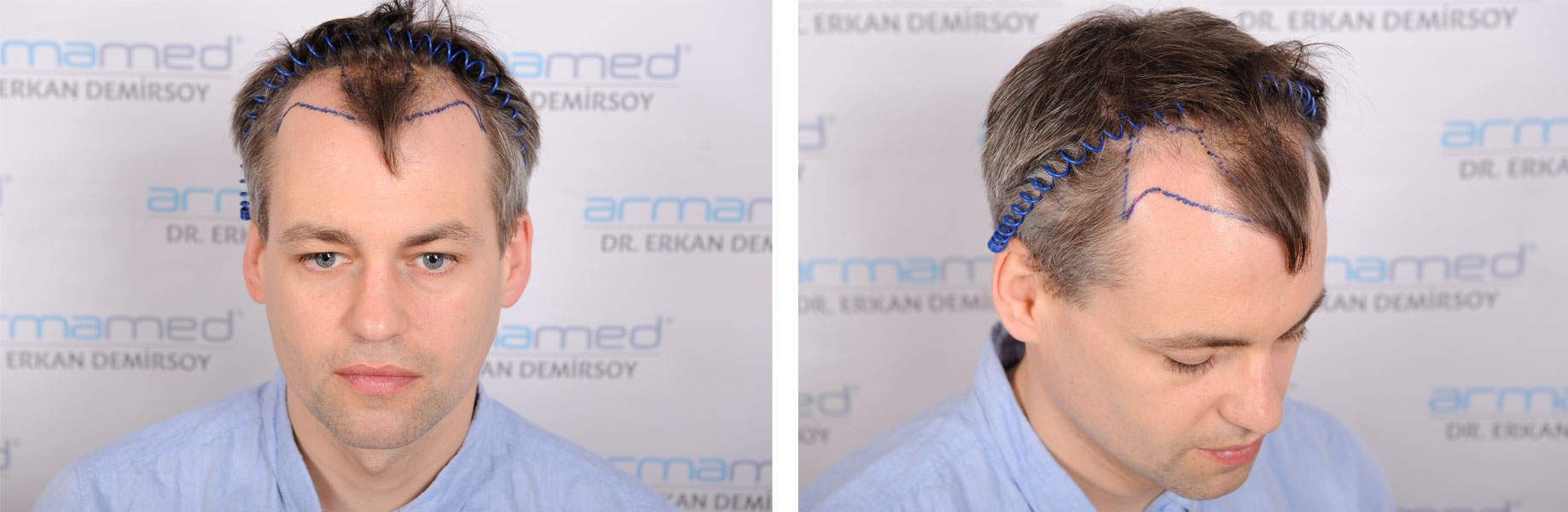 index.php/fa/35703/0/