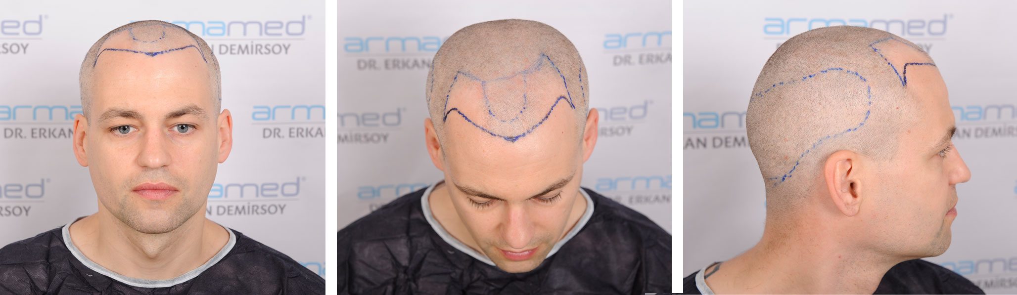 index.php/fa/35704/0/