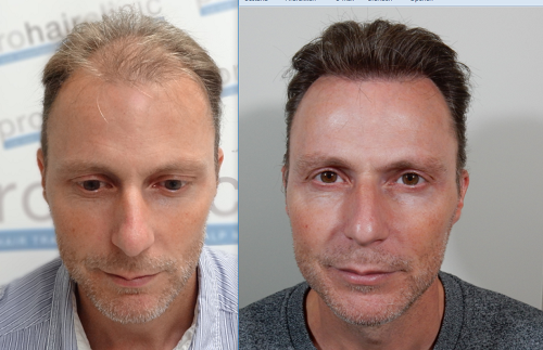 index.php/fa/35728/0/