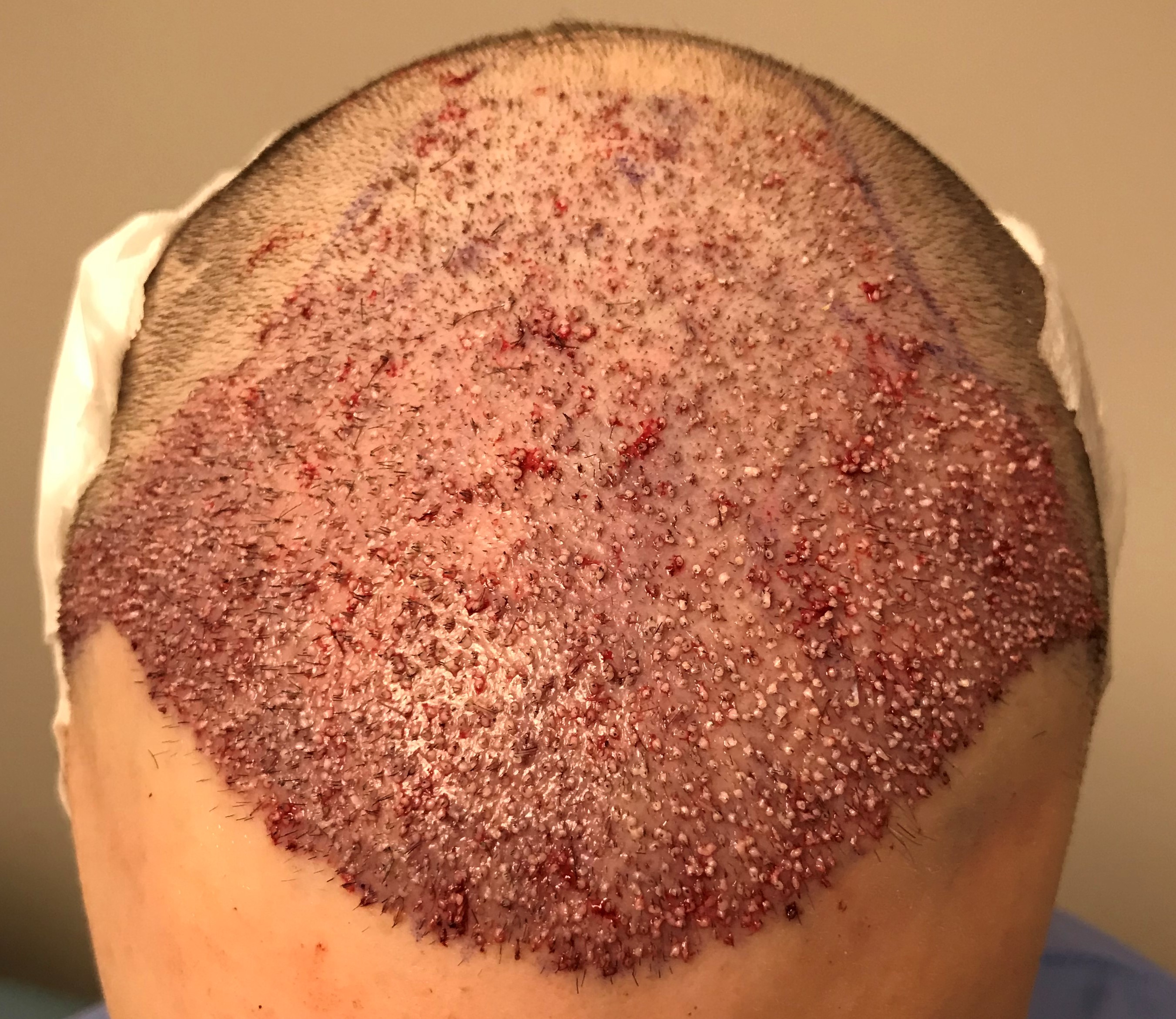 index.php/fa/36082/0/