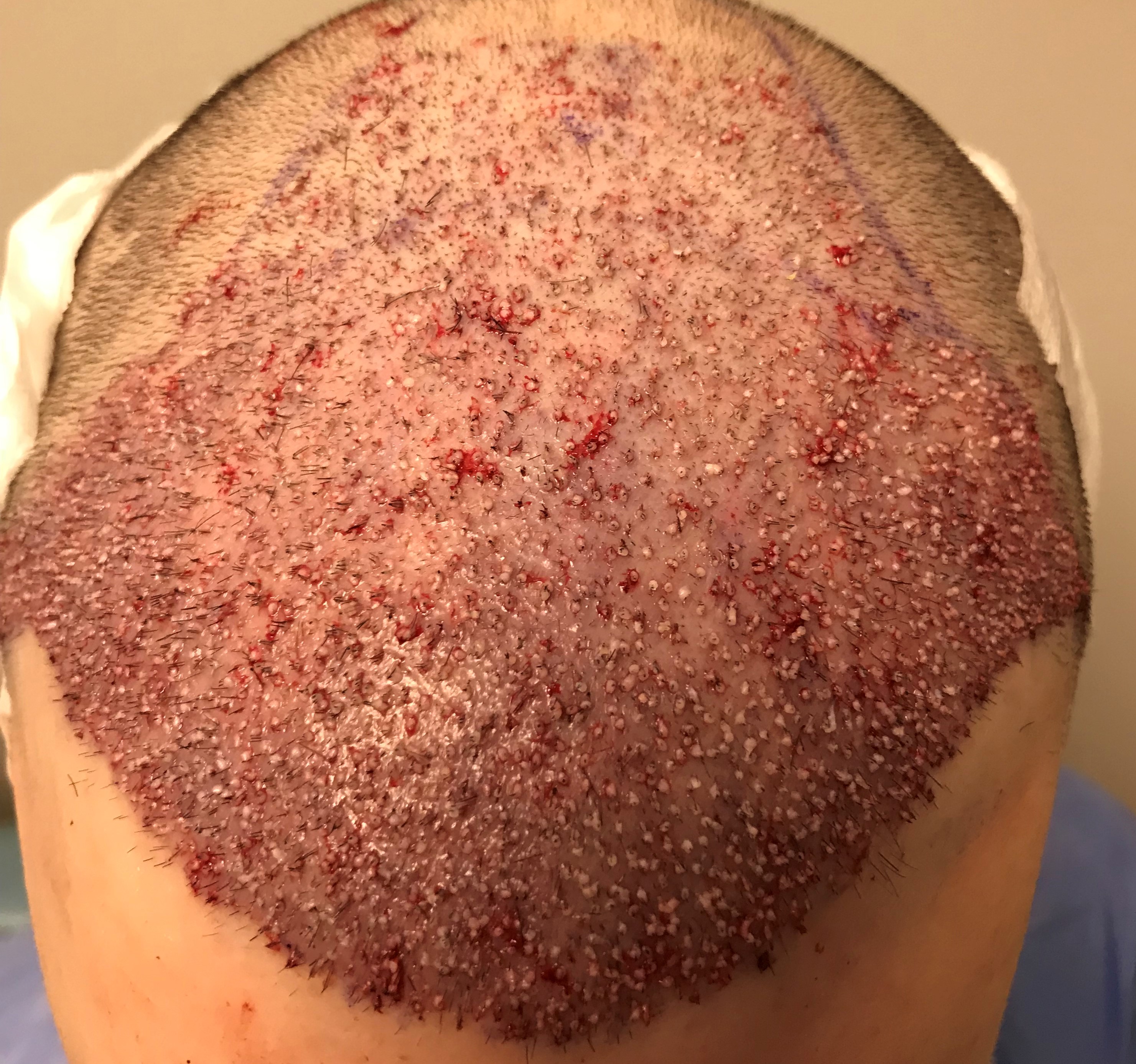 index.php/fa/36083/0/