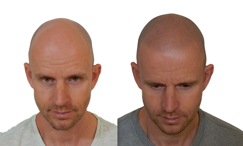 index.php/fa/36120/0/