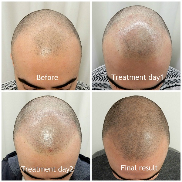 index.php/fa/36121/0/