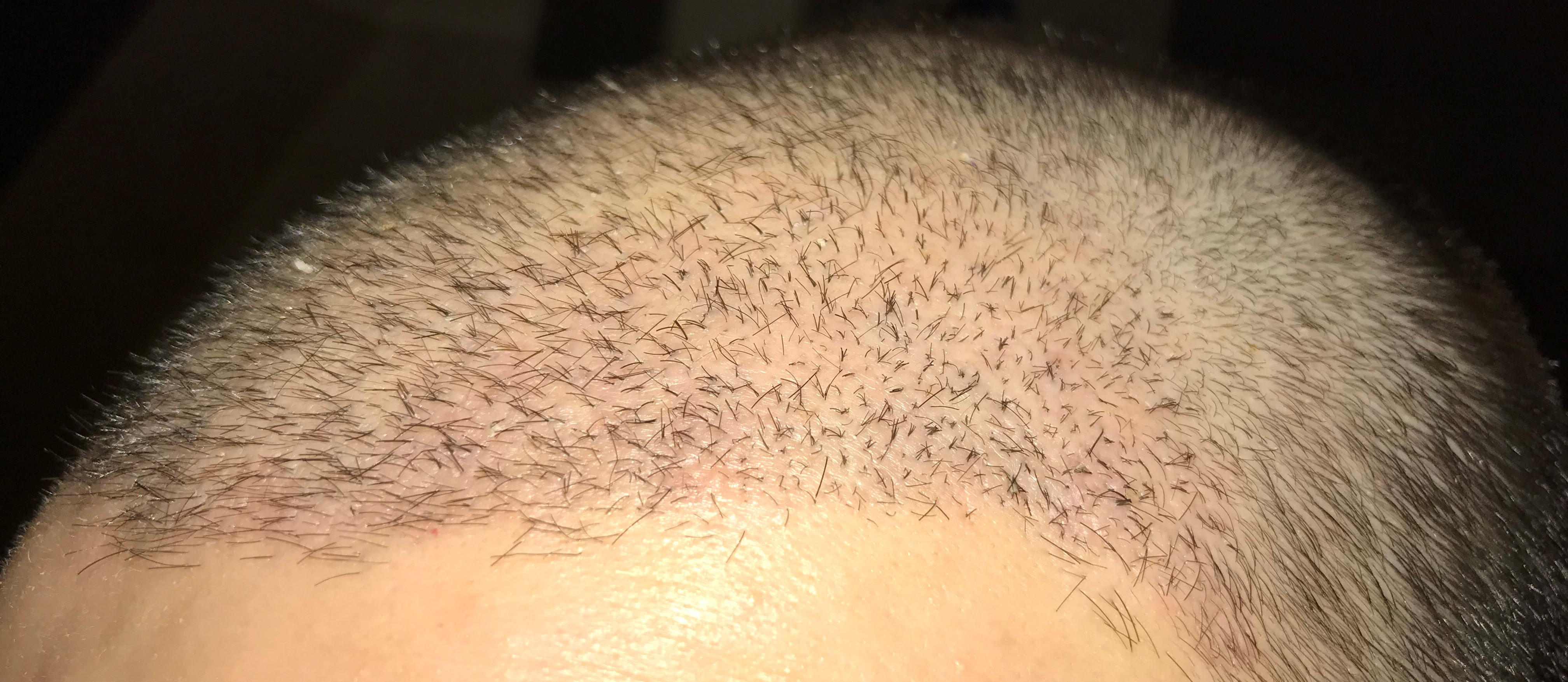 index.php/fa/36156/0/