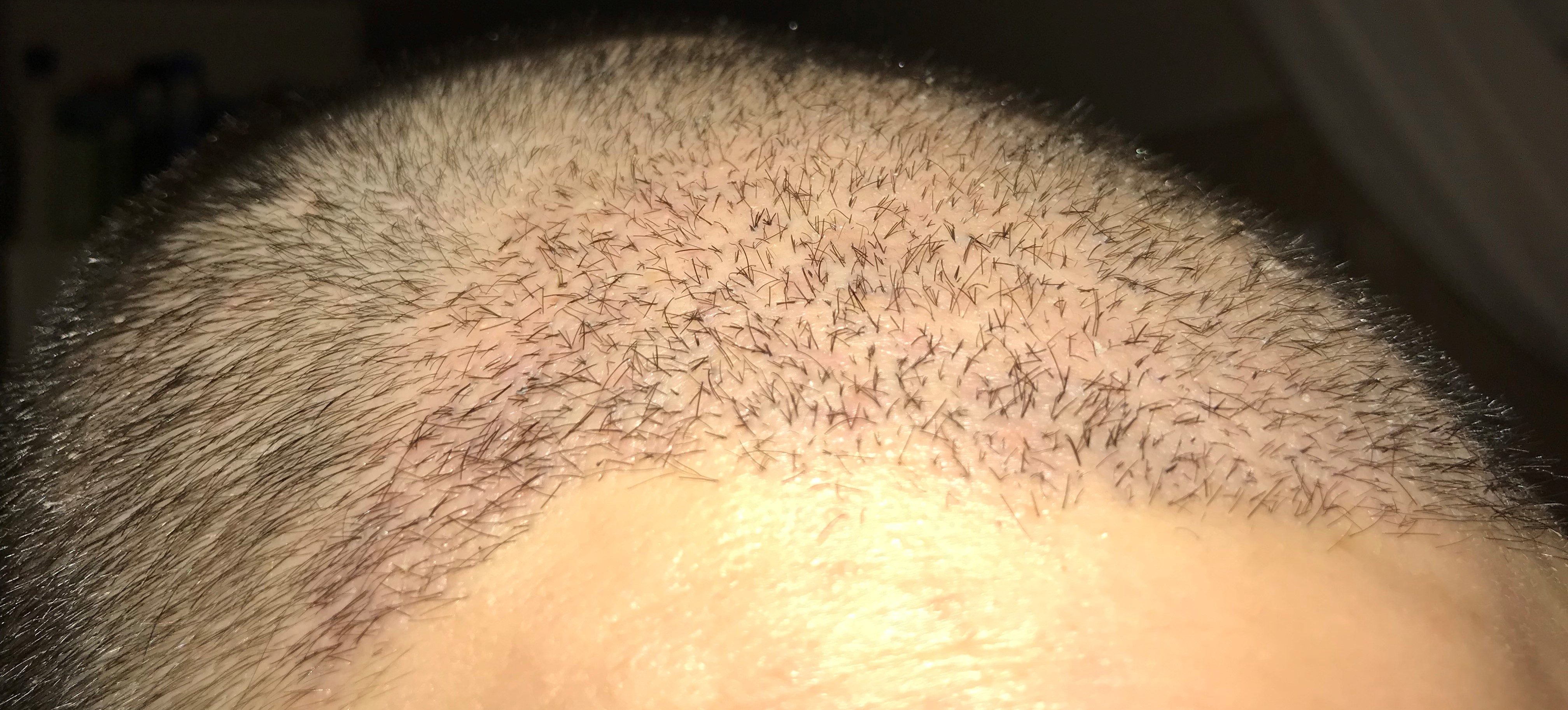 index.php/fa/36157/0/