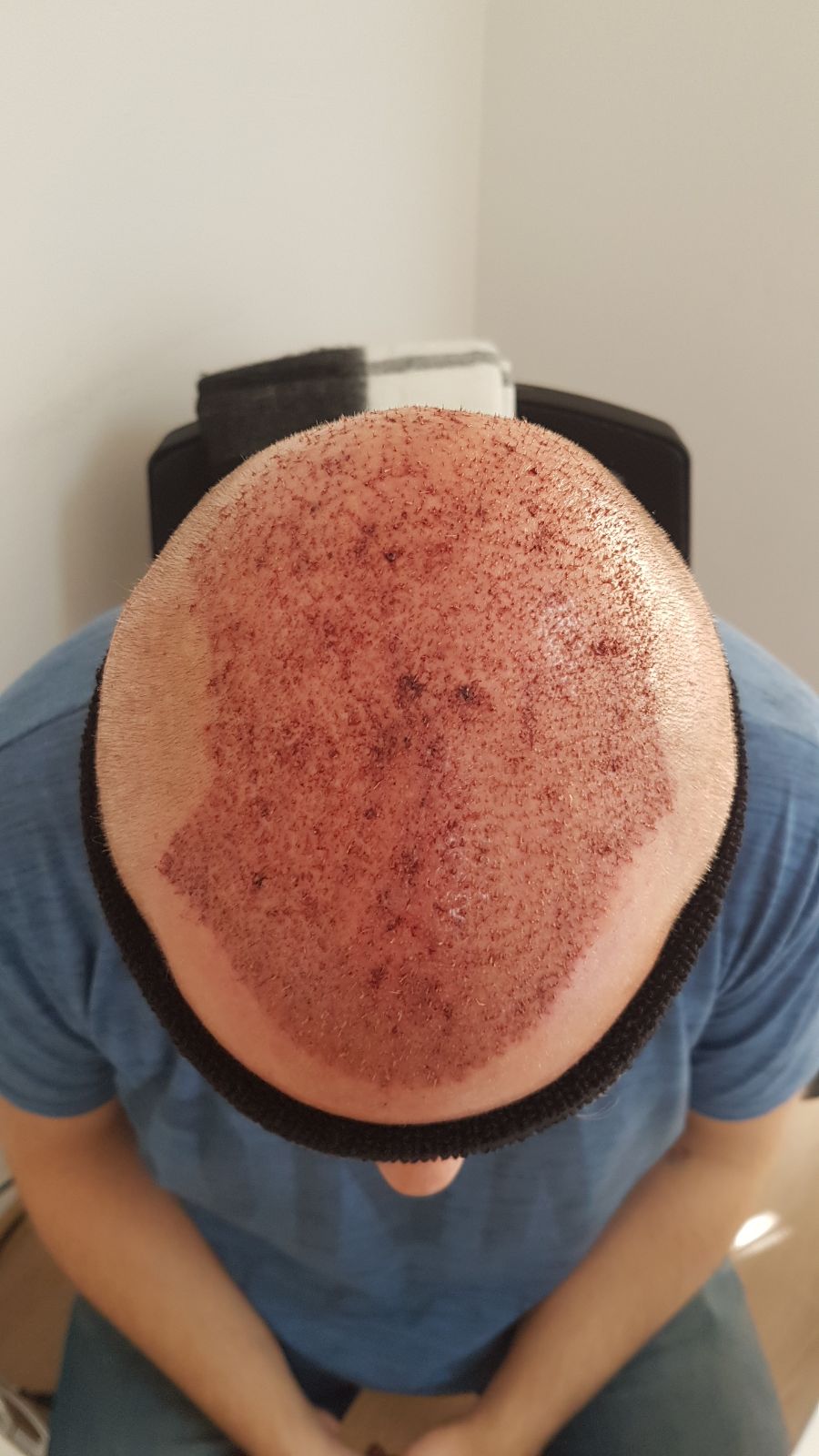 index.php/fa/36160/0/