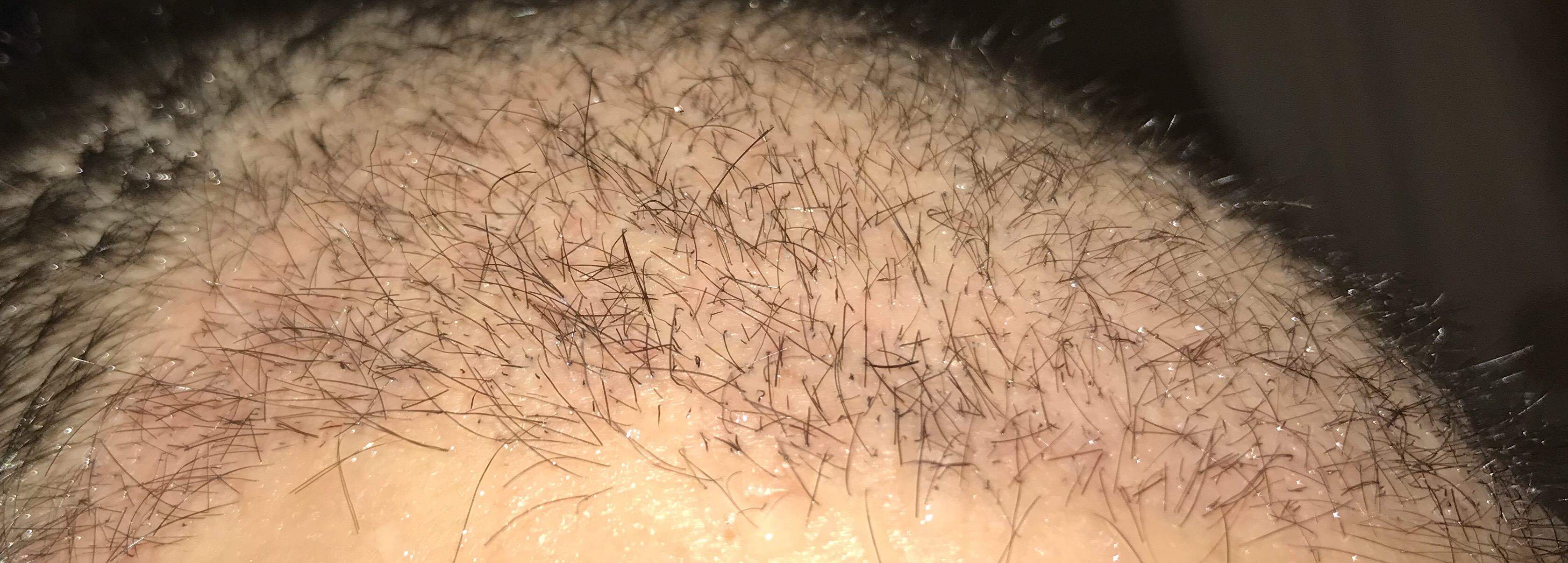 index.php/fa/36238/0/