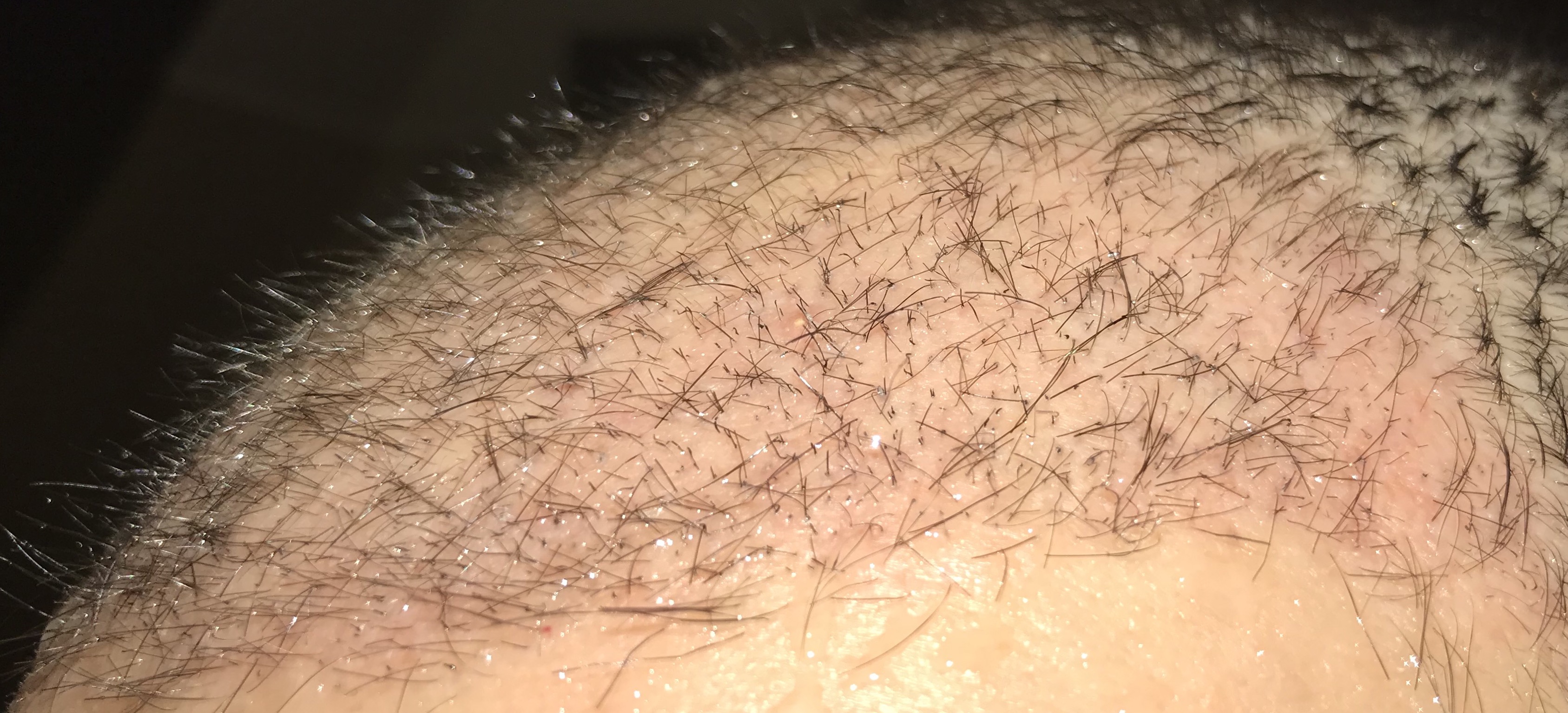 index.php/fa/36239/0/