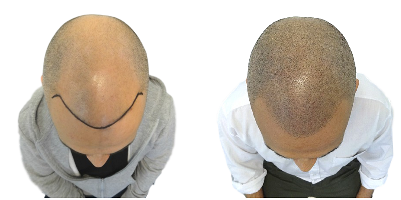 index.php/fa/36245/0/