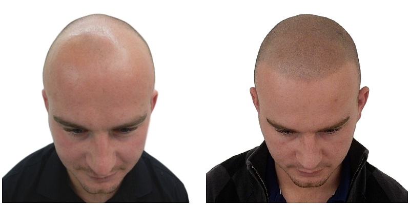 index.php/fa/36299/0/