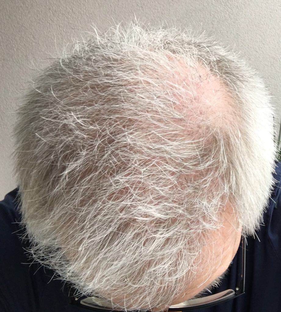 index.php/fa/36435/0/