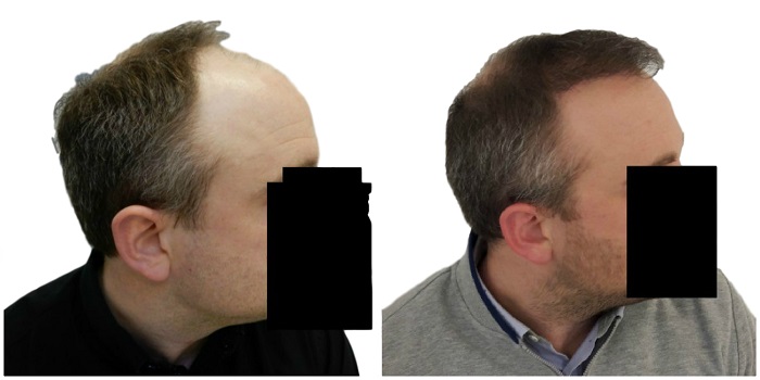 index.php/fa/36594/0/