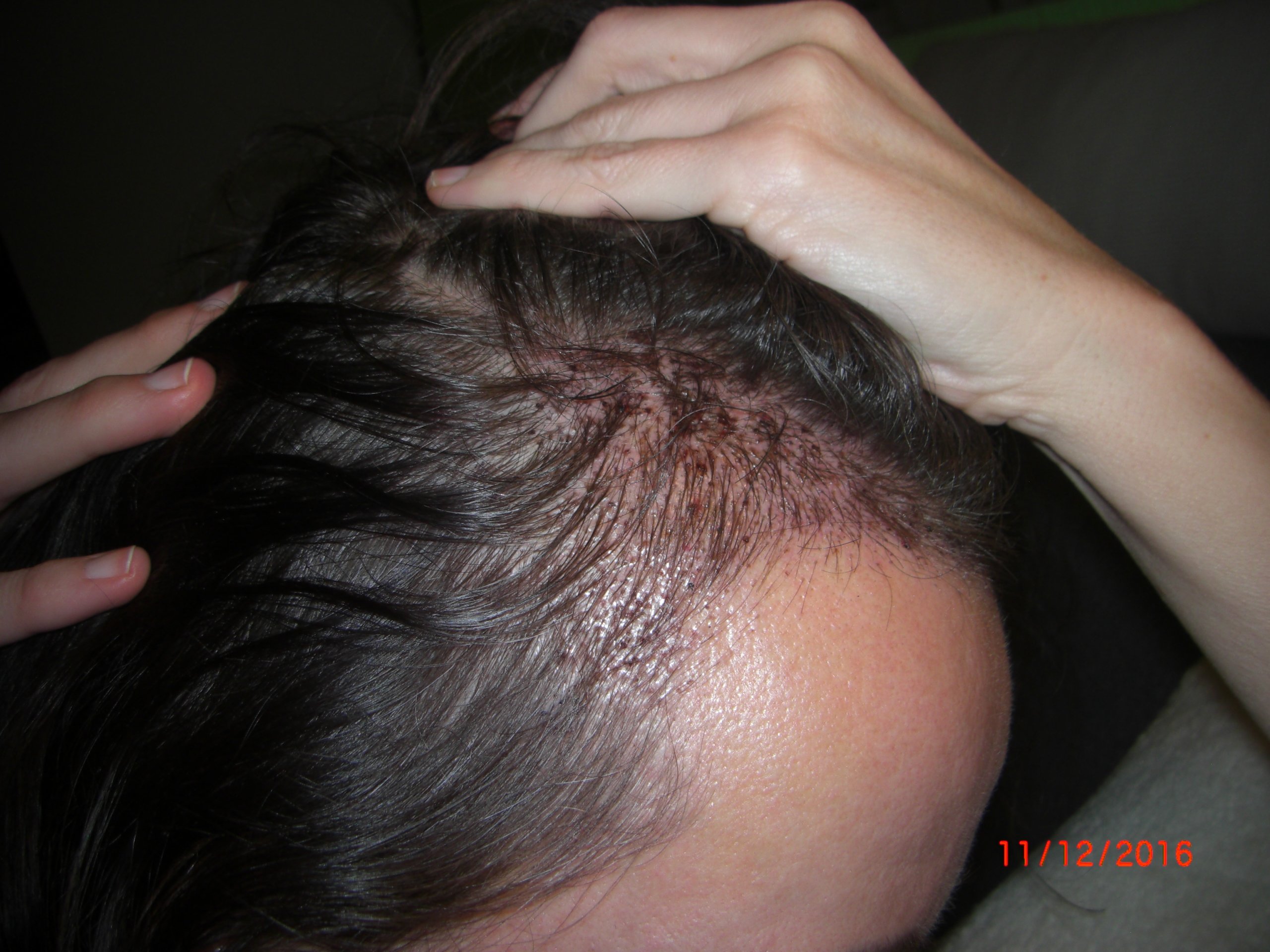 index.php/fa/36615/0/