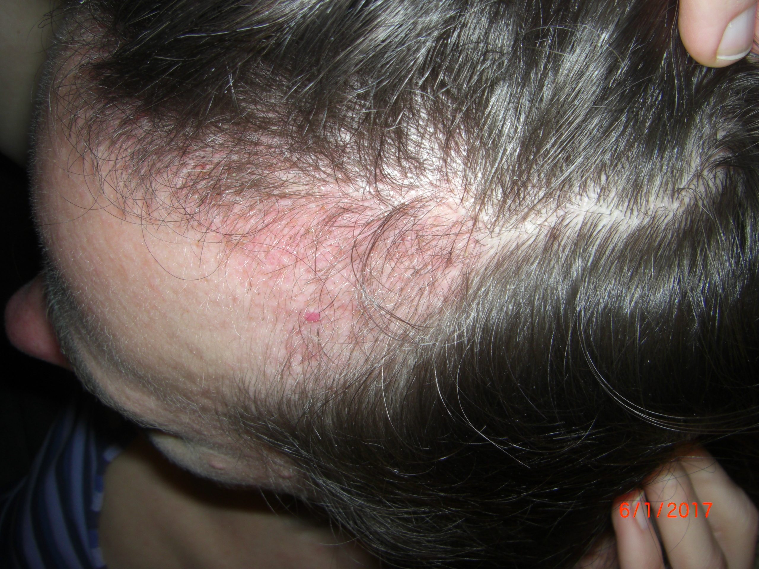 index.php/fa/36616/0/