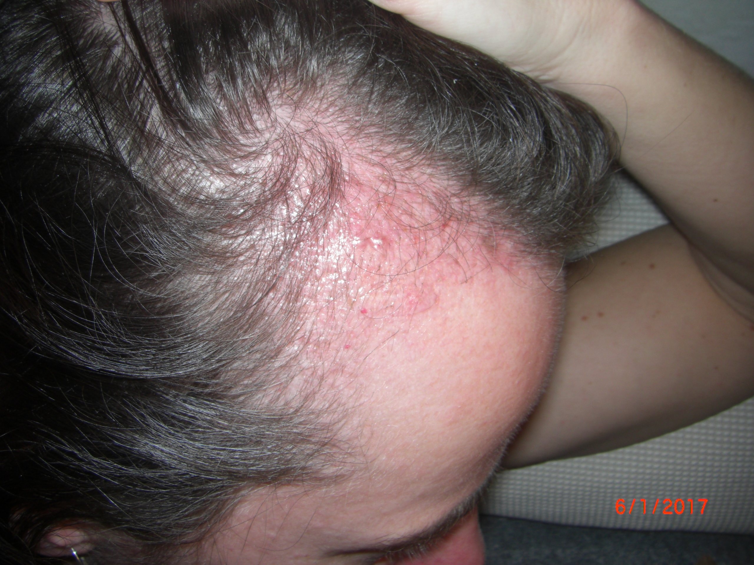 index.php/fa/36617/0/