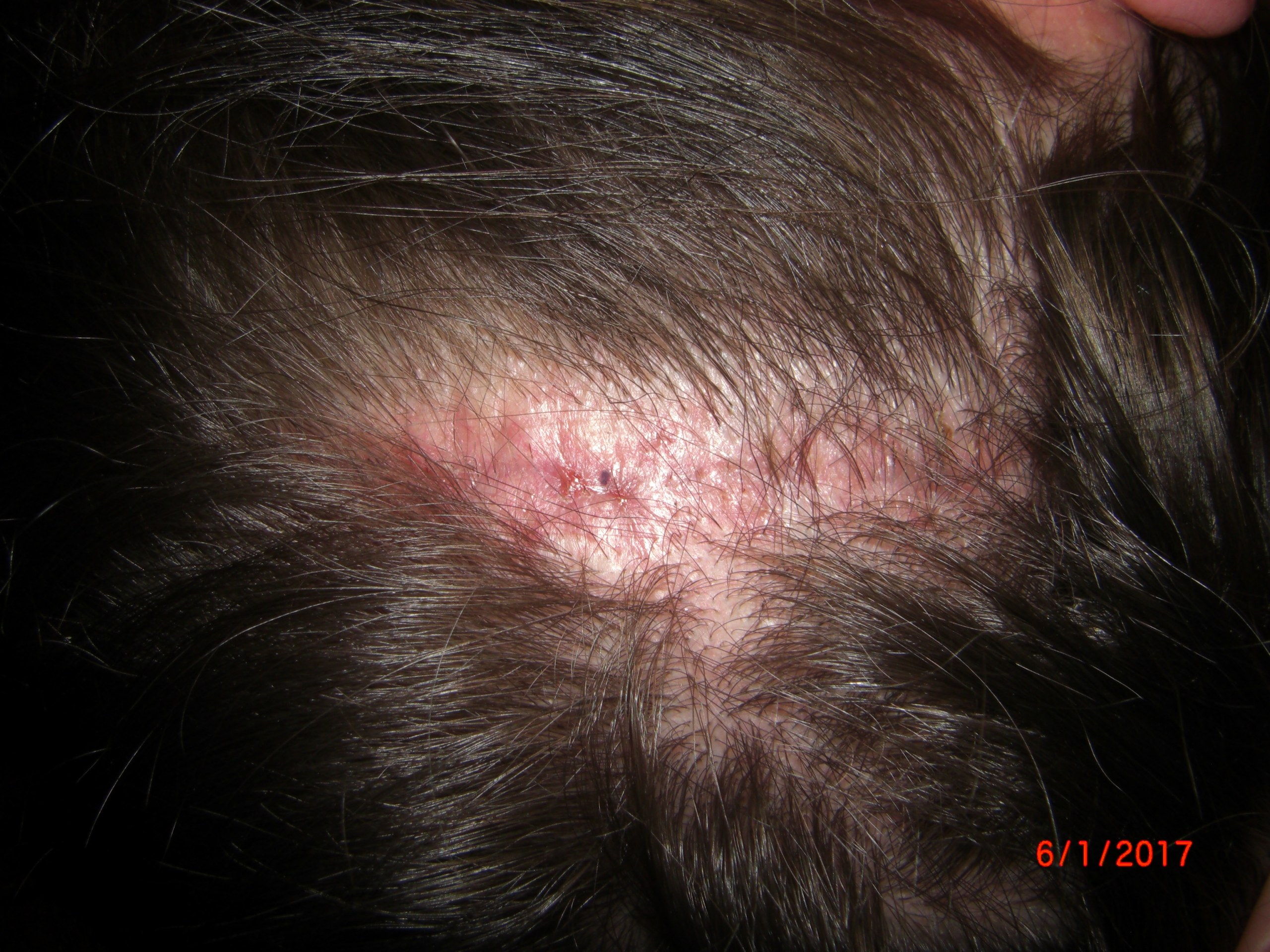 index.php/fa/36618/0/