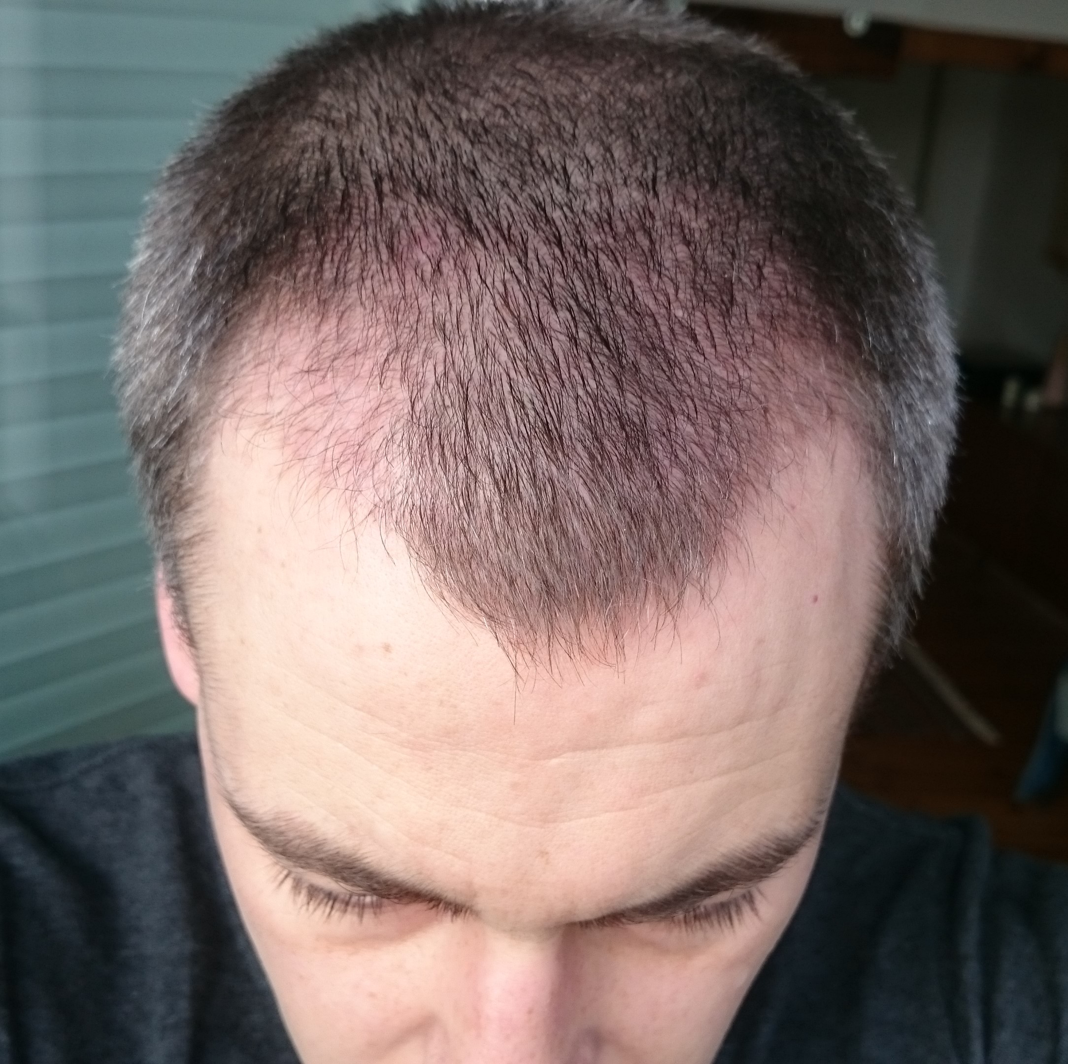 index.php/fa/36765/0/