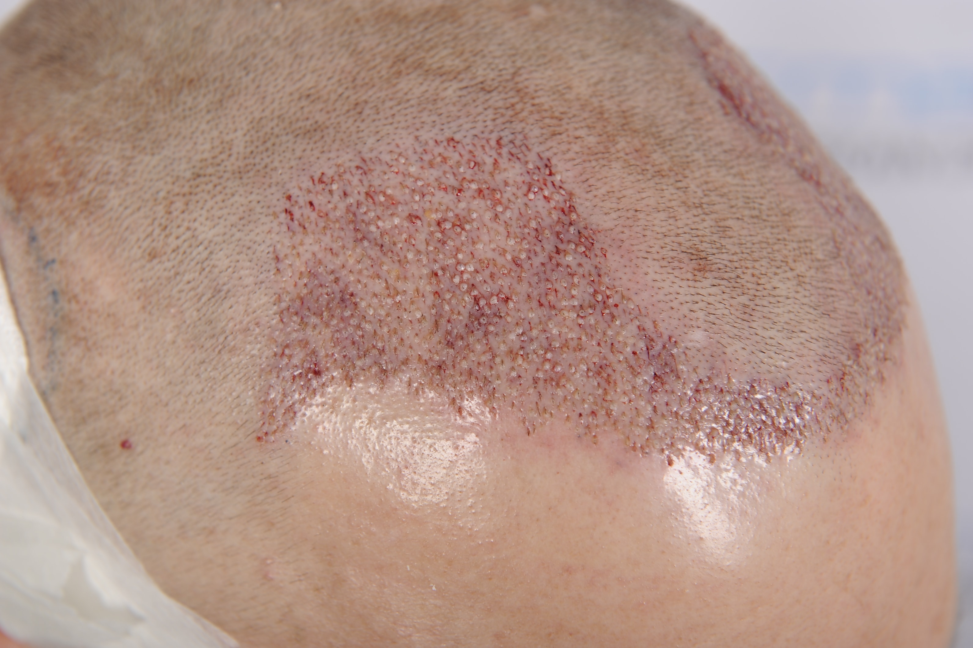 index.php/fa/37099/0/