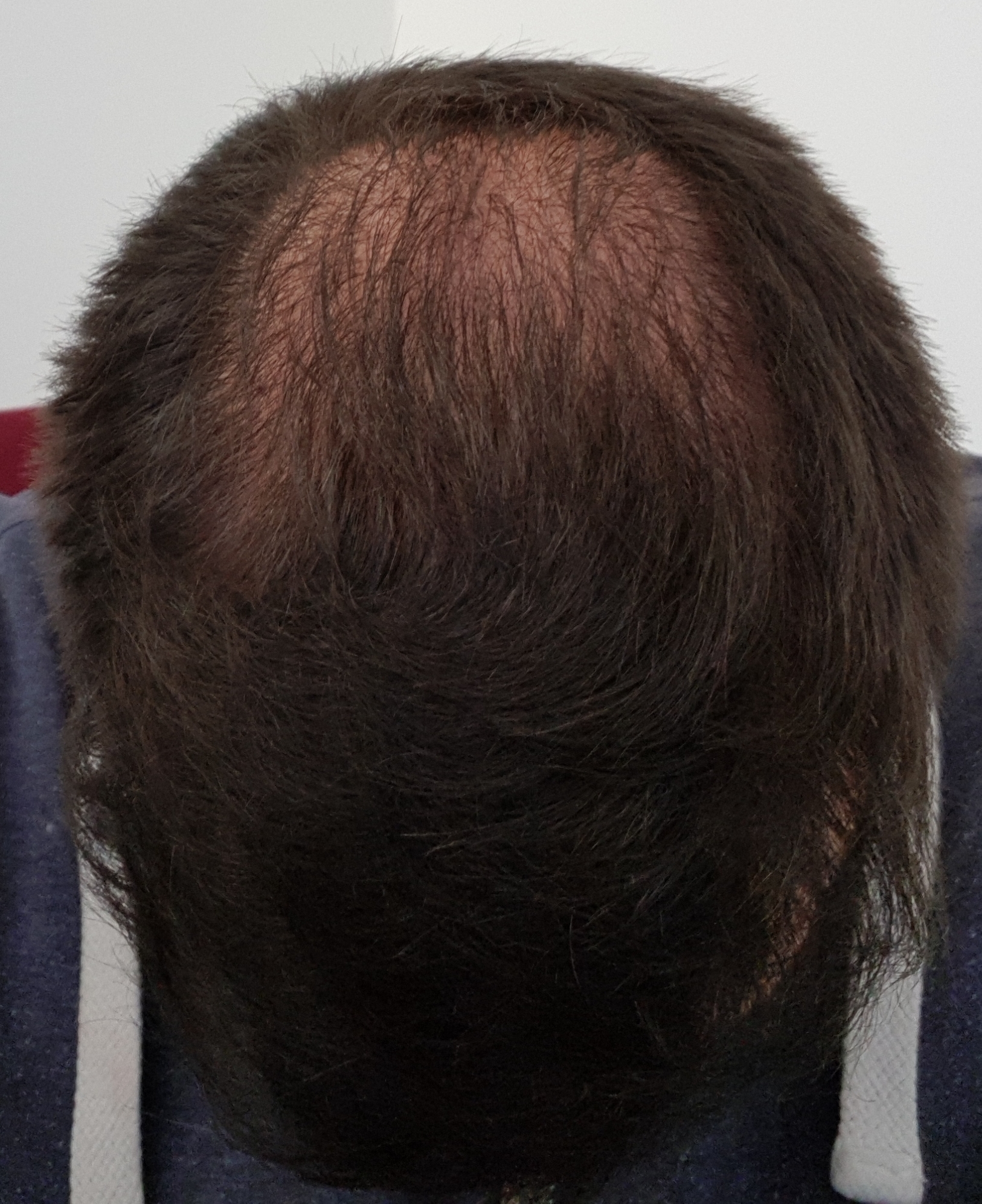 index.php/fa/37215/0/