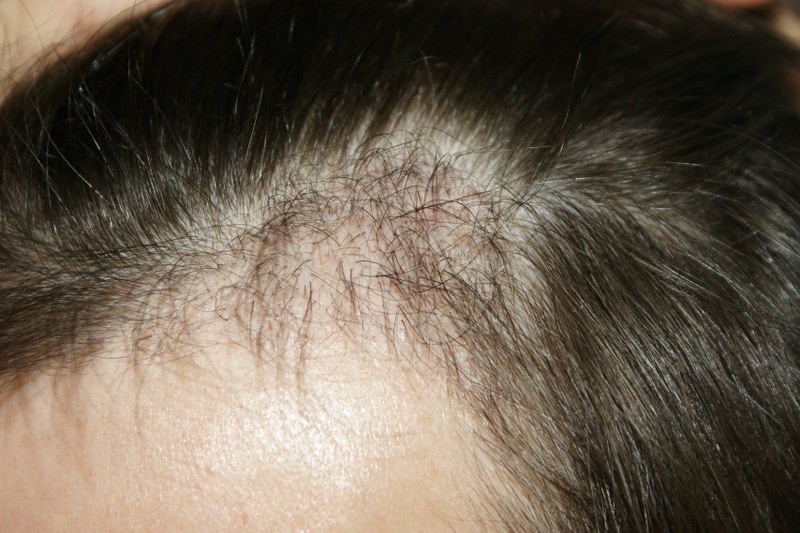 index.php/fa/3740/0/