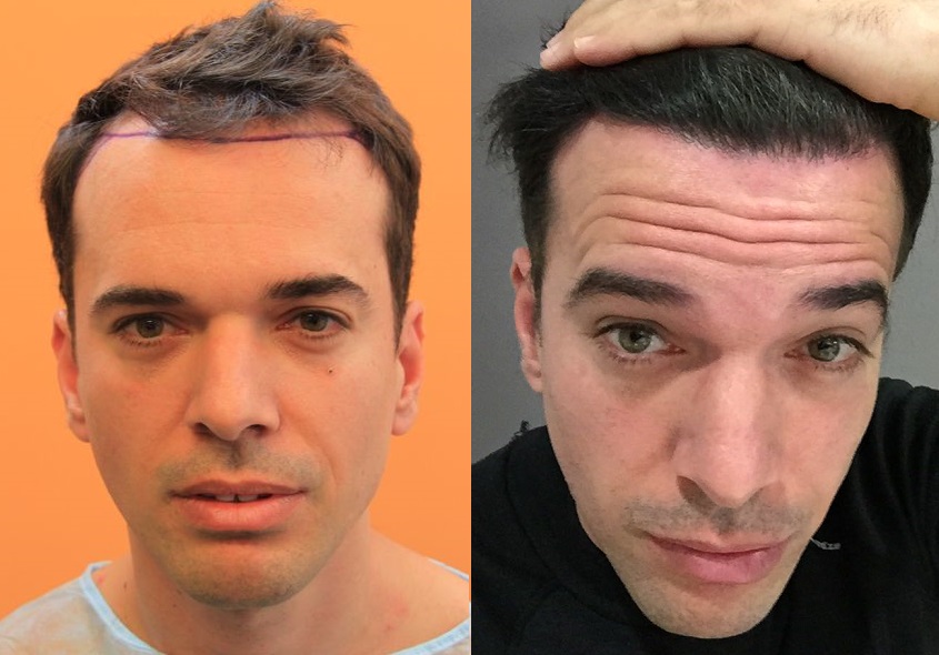 index.php/fa/37446/0/