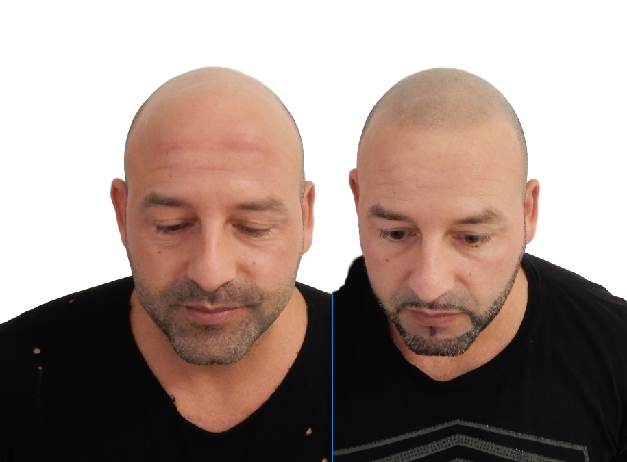 index.php/fa/37451/0/