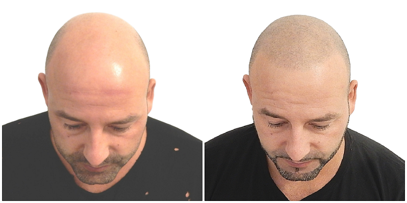 index.php/fa/37565/0/