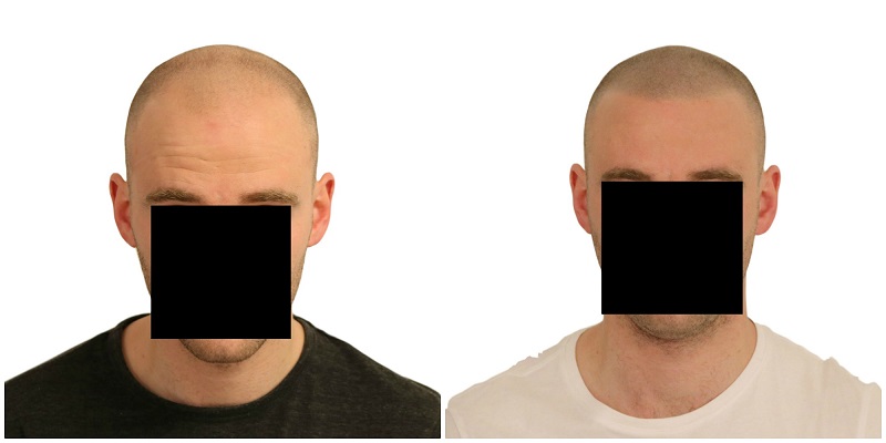 index.php/fa/37599/0/